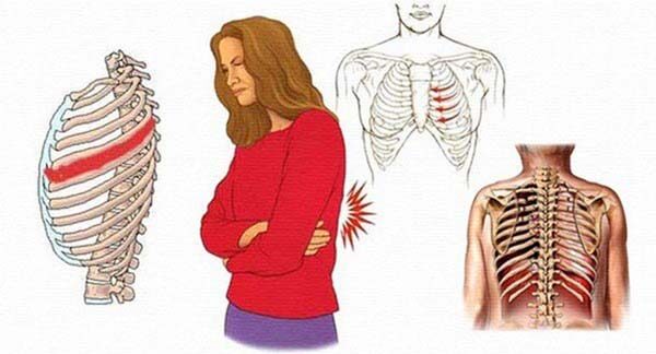 Nguyên nhân đau tức ngực khi tập thể dục