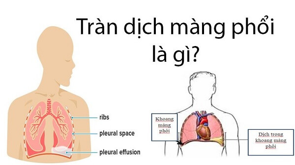 nguyen-nhan-dau-tuc-nguc-khi-tap-the-duc-4