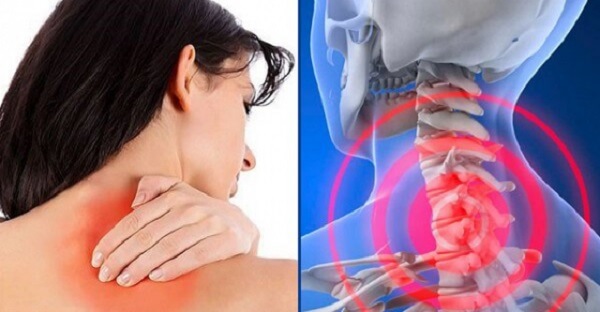 Những triệu chứng đau đầu sau gáy giúp giảm trí nhớ