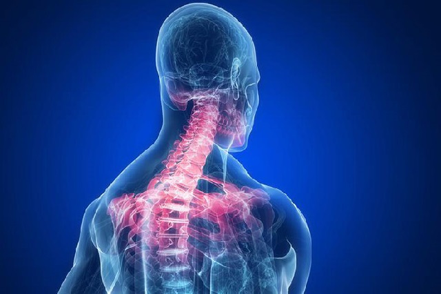Nguyên nhân, triệu chứng và cách chữa thoái hóa đốt sống cổ