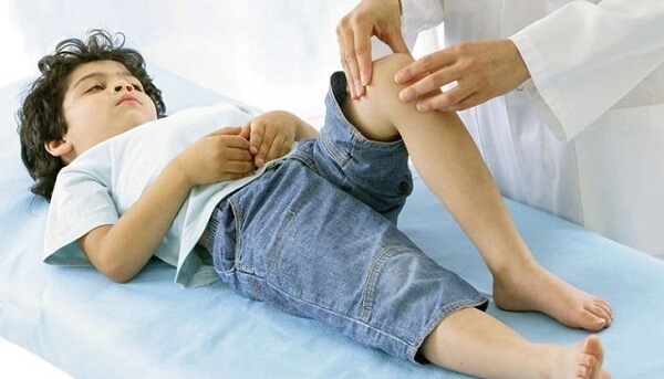 Viêm khớp gối ở trẻ em cần biết sớm và điều trị kịp thời
